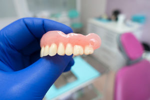 a dentist holds dental implants example as he explains snap-on overdentures in gulfgate tx