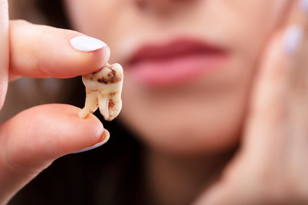 how does tooth decay develop woman looking at a tooth wondering how does tooth decay develop