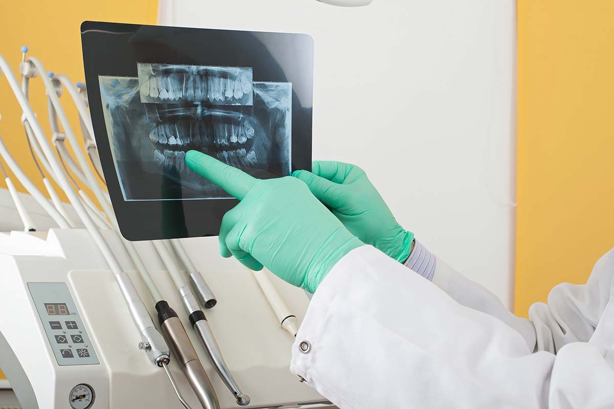 What is a Dental Emergency a dentist takes an xray for a dental emergency
