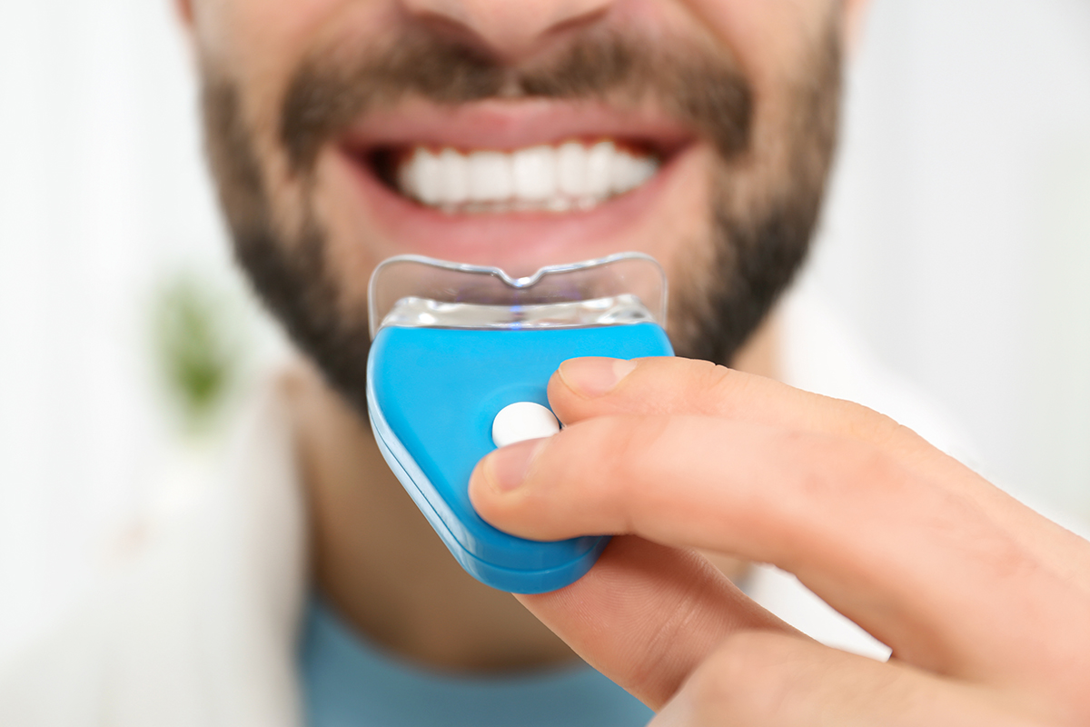 teeth whitening options man getting professional teeth whitening options