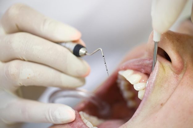 Causes-of-Receding-Gums (1) patient being treated for receding gums