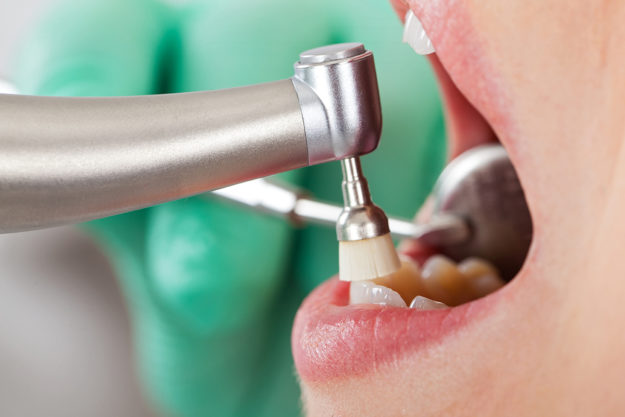 dental health services patient having a teeth cleaning as part of their dental health services