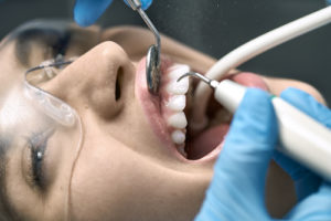 tooth extraction in progress