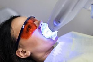 woman getting teeth whitening treatment